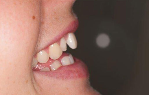  - zdjęcie przed zabiegiem stomatologicznym
